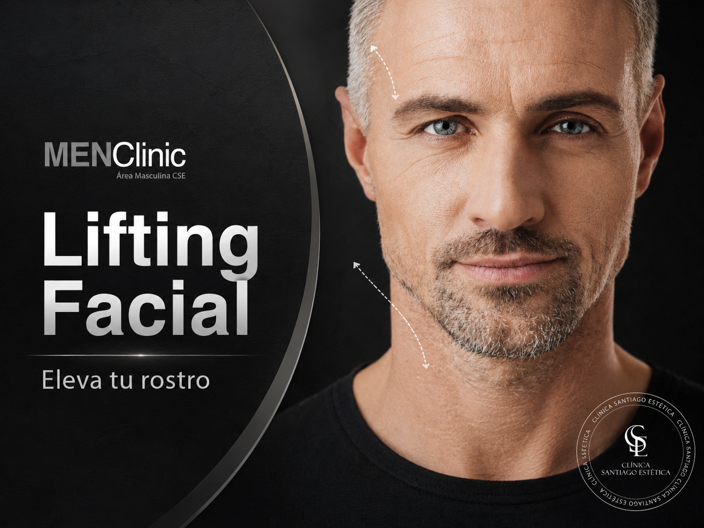 Lifting facial masculino en MenClinic Santiago